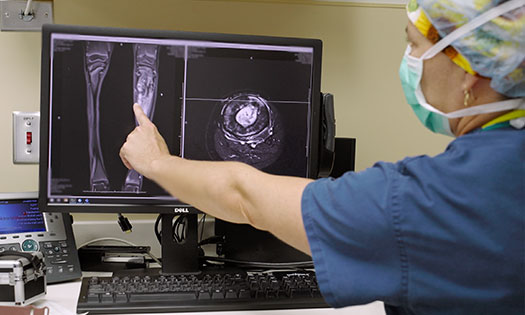 limb-surgery-thumbnail